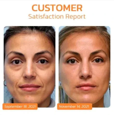 Before and after comparison showing improved firming and hydration effects of Collagen Soluble Eye Mask on under-eye area
