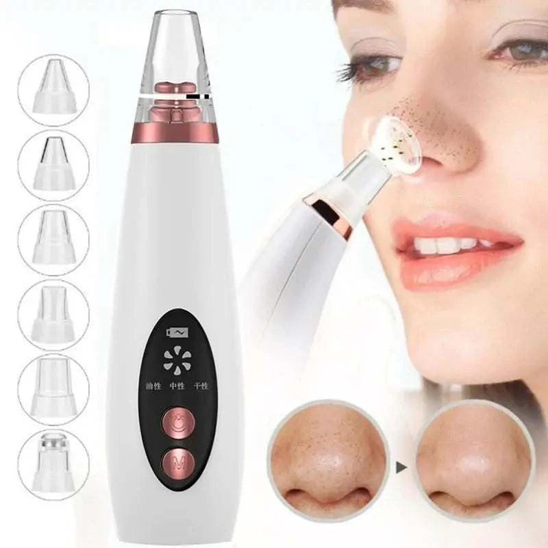 USB Rechargeable Blackhead Remover Vacuum in use, showing multiple suction nozzles and close-up on skin.
